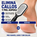 LIMA PARA CALLOS