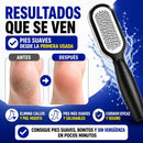 LIMA PARA CALLOS